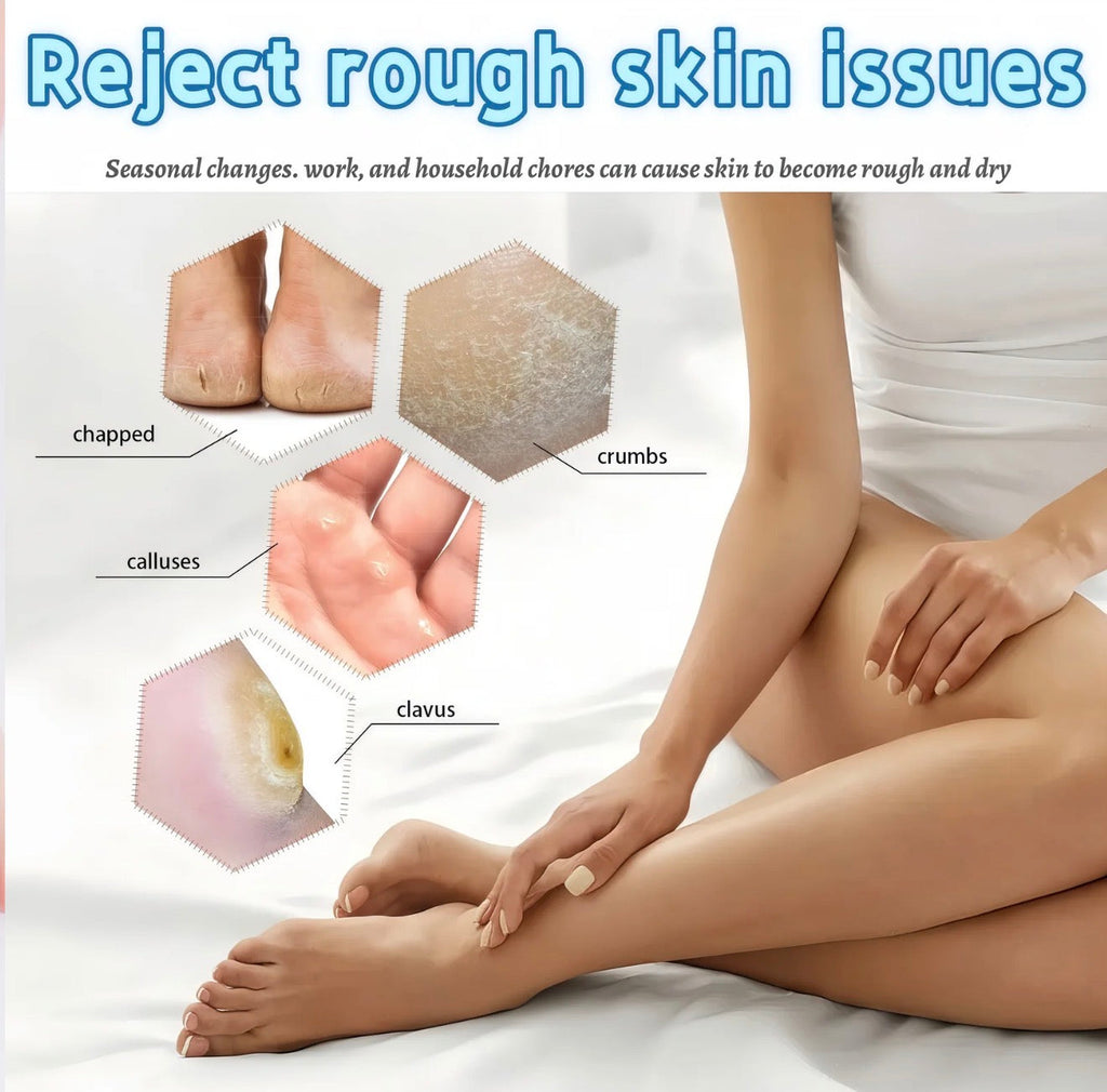 HeelGuard Foot Cream